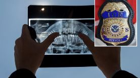 La odontología forense ha causado polémica. Getty / ICE